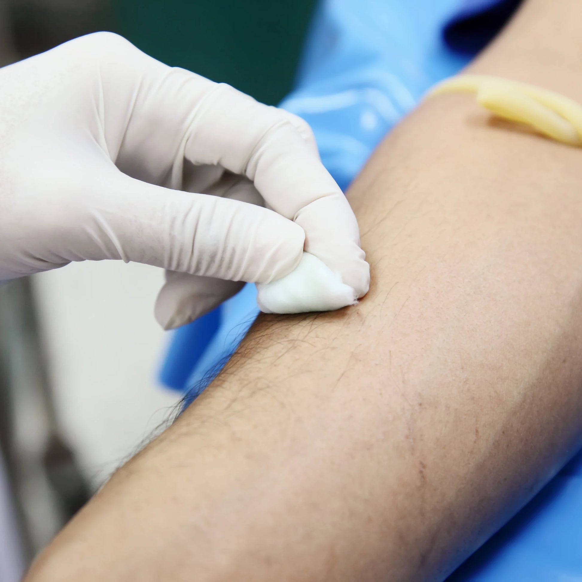 Profesional sanitario limpiando con una gasa y Alcohol Etílico 96º la piel sana del brazo antes de una extracción de sangre