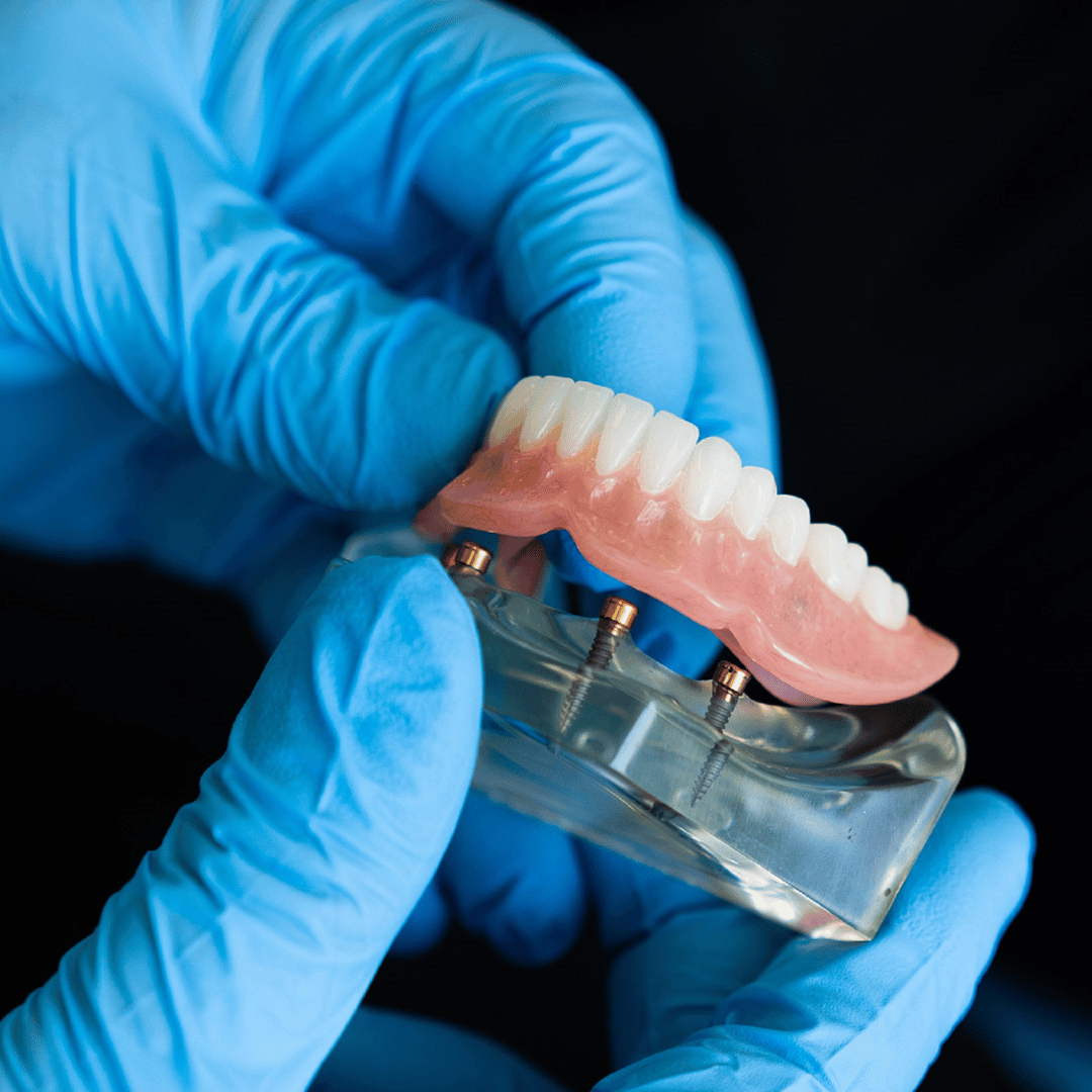 Dentista utilizando guantes de nitrilo azul sin polvo durante una consulta en Gran Canaria. Máxima sensibilidad táctil y protección sin látex.